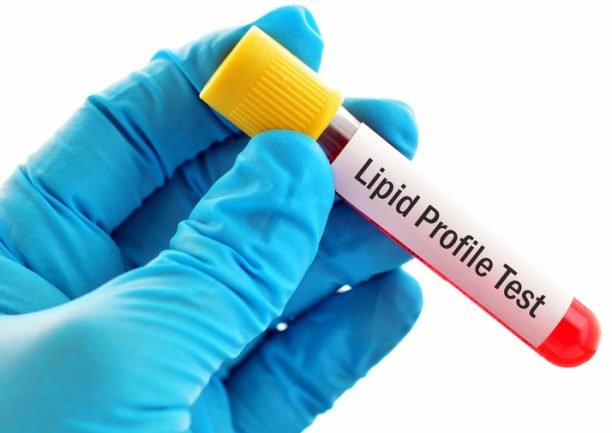 Lipid